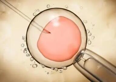 卵巢左右两侧总共有2个优势卵泡哪个会先排