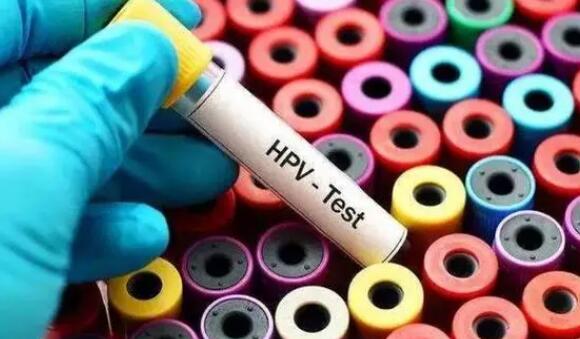 在公立医院做一次HIV检查多少钱附检查流程及注意事项