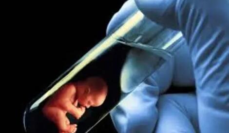 做试管婴儿也会出现畸形儿，多半与染色体异常有关